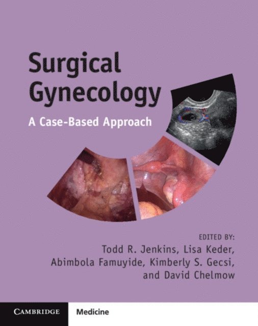 David Chelmow, Kimberly S. Gecsi, Abimola Famuyide, Lisa Keder, Todd R. Jenkins - Surgical Gynecology, E-bok