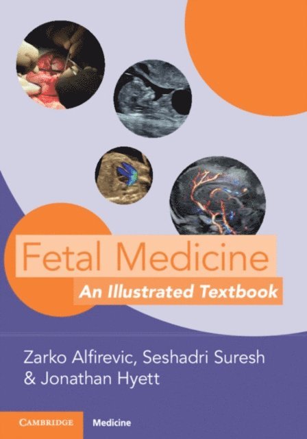 Jonathan Hyett, Seshadri Suresh, Zarko Alfirevic - Fetal Medicine, E-bok