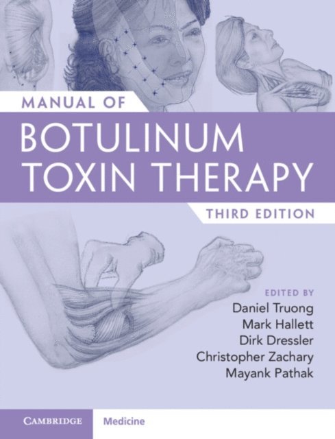 Mayank Pathak, Christopher Zachary, Mark Hallett, Dirk Dressler, Daniel Truong - Manual of Botulinum Toxin Therapy, E-bok