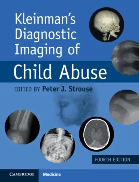 Peter J. Strouse - Kleinman's Diagnostic Imaging of Child Abuse, E-bok. Tillgänglighet: Lägg i varukorg