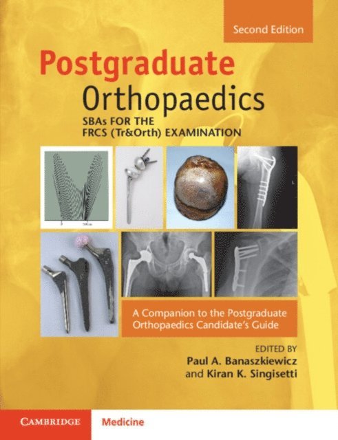 Kiran Singisetti, Paul A. Banaszkiewicz - SBAs for the FRCS (Tr&Orth) Examination, E-bok