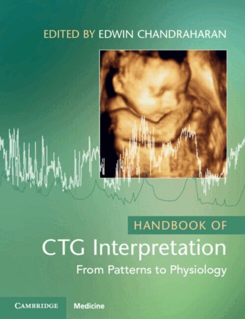 Edwin Chandraharan - Handbook of CTG Interpretation, E-bok