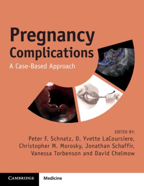 David Chelmow, Vanessa Torbenson, Jonathan Schaffir, Christopher M. Morosky, D. Yvette LaCoursiere, Peter F. Schnatz - Pregnancy Complications, E-bok