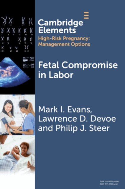 Philip J. Steer, Lawrence D. Devoe, Mark I. Evans - Fetal Compromise in Labor, E-bok
