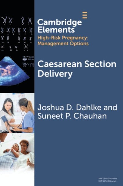 Suneet P. Chauhan, Joshua D. Dahlke - Caesarean Section Delivery, E-bok