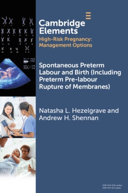 Andrew Shennan, Natasha L. Hezelgrave - Spontaneous Preterm Labour and Birth (Including Preterm Pre-labour Rupture of Membranes), E-bok