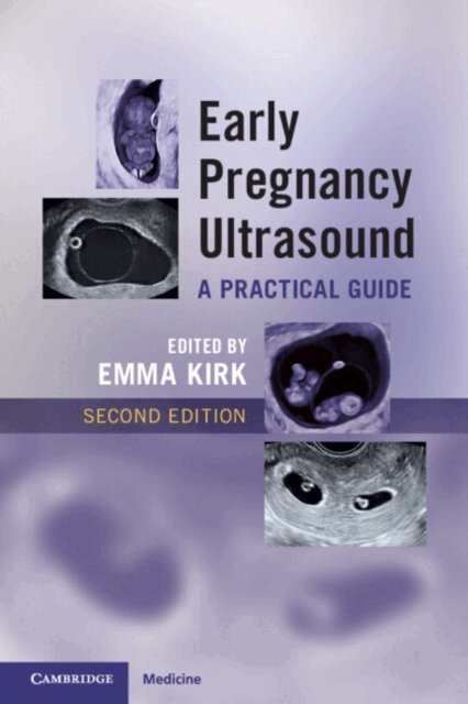 Emma Kirk - Early Pregnancy Ultrasound, E-bok. Tillgänglighet: Lägg i varukorg