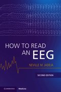 How to Read an EEG
