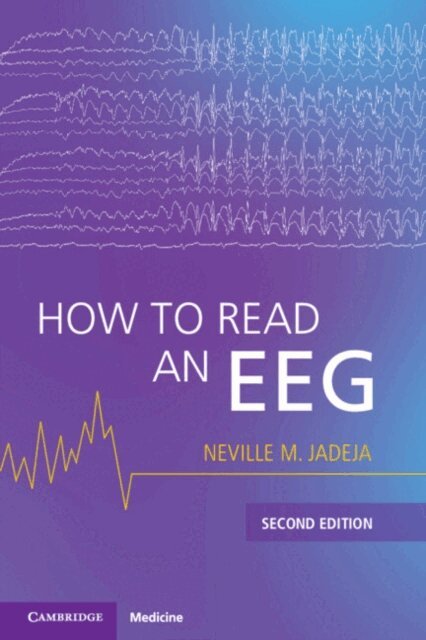 Neville M. Jadeja - How to Read an EEG, E-bok. Tillgänglighet: Lägg i varukorg
