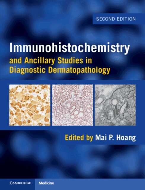 Mai P. Hoang - Immunohistochemistry and Ancillary Studies in Diagnostic Dermatopathology, E-bok