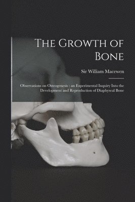 William Macewen - Growth of Bone, Häftad