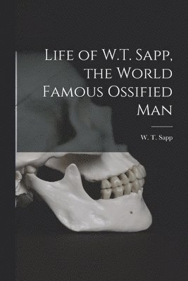 Life of W.T. Sapp, the World Famous Ossified Man