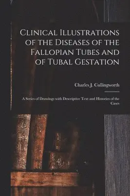 Clinical Illustrations of the Diseases of the Fallopian Tubes and of Tubal Gestation