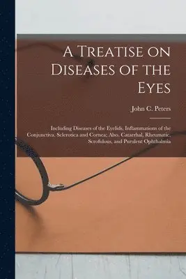 John C. (John Charles) Peters - Treatise on Diseases of the Eyes; Including Diseases of the Eyelids, Inflammations of the Conjunctiva, Sclerotica and Cornea; Also, Catarrhal, Rheumatic, Scrofulous, and Purulent Ophthalmia, Häftad. Tillgänglighet: Lägg i varukorg