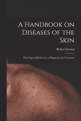 Handbook on Diseases of the Skin [electronic Resource]