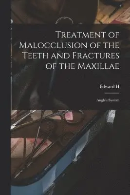 Edward H 1855-1930 Angle - Treatment of Malocclusion of the Teeth and Fractures of the Maxillae, Häftad. Tillgänglighet: Lägg i varukorg