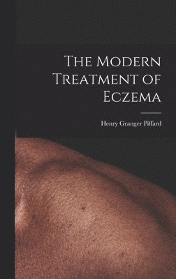 Henry Granger Piffard - Modern Treatment of Eczema, Inbunden. Tillgänglighet: Lägg i varukorg