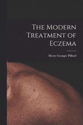 Henry Granger Piffard - Modern Treatment of Eczema, Häftad. Tillgänglighet: Lägg i varukorg