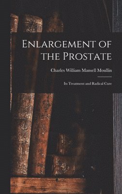 Charles William Mansell Moullin - Enlargement of the Prostate, Inbunden. Tillgänglighet: Tillfälligt slut