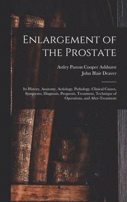 John Blair Deaver, Astley Paston Cooper Ashhurst - Enlargement of the Prostate, Inbunden. Tillgänglighet: Lägg i varukorg