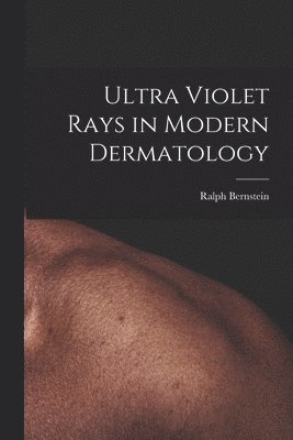 Ultra Violet Rays in Modern Dermatology