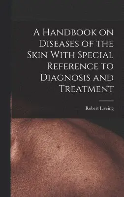 Robert Liveing - Handbook on Diseases of the Skin With Special Reference to Diagnosis and Treatment, Inbunden. Tillgänglighet: Lägg i varukorg