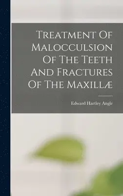Edward Hartley Angle - Treatment Of Malocculsion Of The Teeth And Fractures Of The Maxillæ, Inbunden. Tillgänglighet: Lägg i varukorg