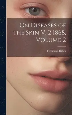 Ferdinand Hebra - On Diseases of the Skin V. 2 1868, Volume 2, Inbunden. Tillgänglighet: Tillfälligt slut