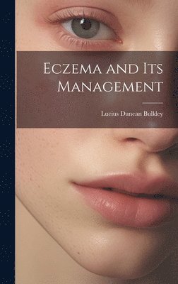 Lucius Duncan Bulkley - Eczema and Its Management, Inbunden. Tillgänglighet: Lägg i varukorg