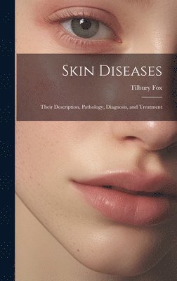 Tilbury Fox - Skin Diseases, Inbunden. Tillgänglighet: Lägg i varukorg