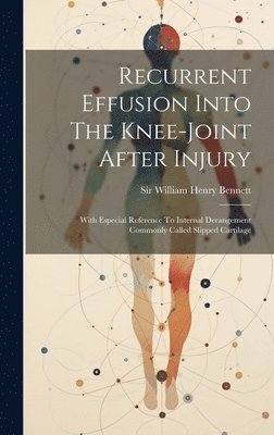 William Henry Bennett - Recurrent Effusion Into The Knee-joint After Injury, Inbunden. Tillgänglighet: Lägg i varukorg