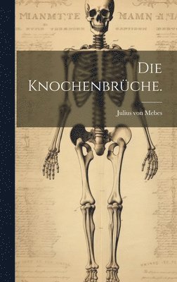 Knochenbrüche.