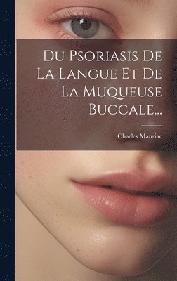 Charles Mauriac - Du Psoriasis De La Langue Et De La Muqueuse Buccale..., Inbunden