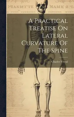 Practical Treatise On Lateral Curvature Of The Spine