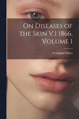 Ferdinand Hebra - On Diseases of the Skin V.1 1866, Volume 1, Häftad. Tillgänglighet: Tillfälligt slut