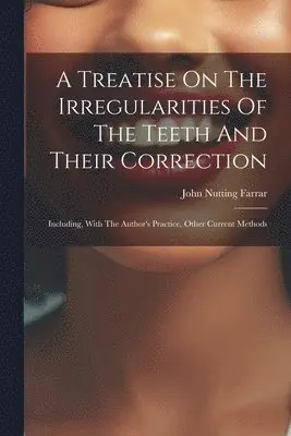 Treatise On The Irregularities Of The Teeth And Their Correction