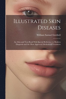 Illustrated Skin Diseases