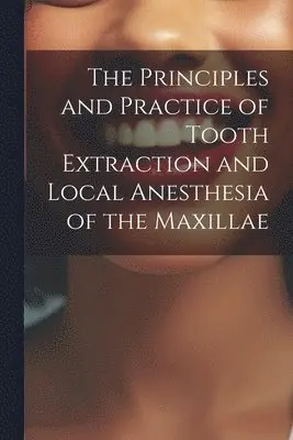 Principles and Practice of Tooth Extraction and Local Anesthesia of the Maxillae