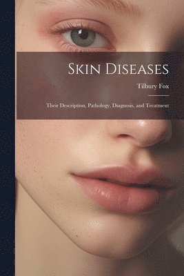 Tilbury Fox - Skin Diseases, Häftad. Tillgänglighet: Lägg i varukorg