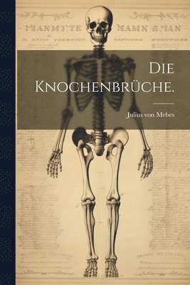 Julius Von Mebes - Knochenbrüche., Häftad. Tillgänglighet: Lägg i varukorg