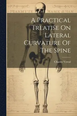 Charles Verral - Practical Treatise On Lateral Curvature Of The Spine, Häftad. Tillgänglighet: Lägg i varukorg
