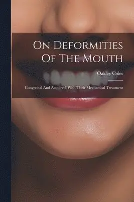 Oakley (James Oakley) Coles - On Deformities Of The Mouth, Häftad. Tillgänglighet: Lägg i varukorg