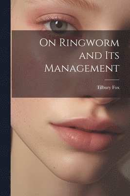 On Ringworm and Its Management