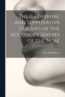 Ross Hall Skillern - Catarrhal and Suppurative Diseases of the Accessory Sinuses of the Nose, Häftad. Tillgänglighet: Lägg i varukorg