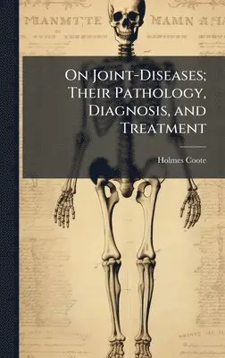 Holmes Coote - On Joint-Diseases; Their Pathology, Diagnosis, and Treatment, Inbunden. Tillgänglighet: Tillfälligt slut