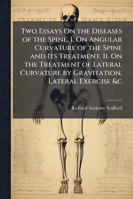 Richard Anthony Stafford - Two Essays On the Diseases of the Spine. I. On Angular Curvature of the Spine and Its Treatment. Ii. On the Treatment of Lateral Curvature by Gravitation, Lateral Exercise &c, Häftad. Tillgänglighet: Lägg i varukorg