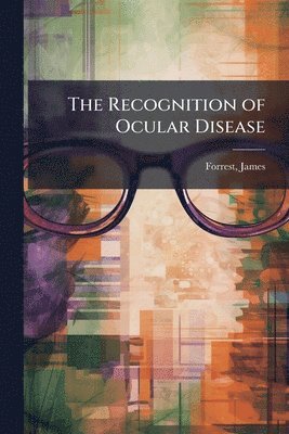 Recognition of Ocular Disease