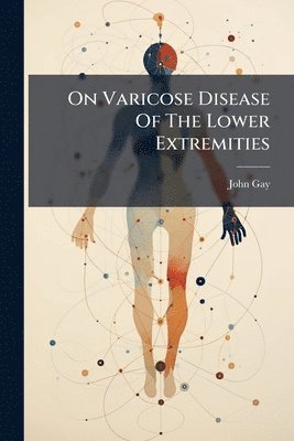 John Gay - On Varicose Disease Of The Lower Extremities, Häftad