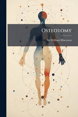 William Macewen - Osteotomy, Häftad