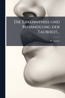 Erkenntniss und Behandlung der Taubheit...